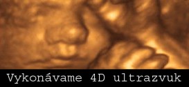 4D ultrazvuk